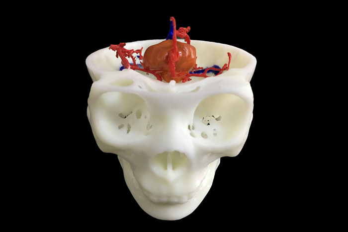 定制式3D打印醫(yī)學(xué)模型